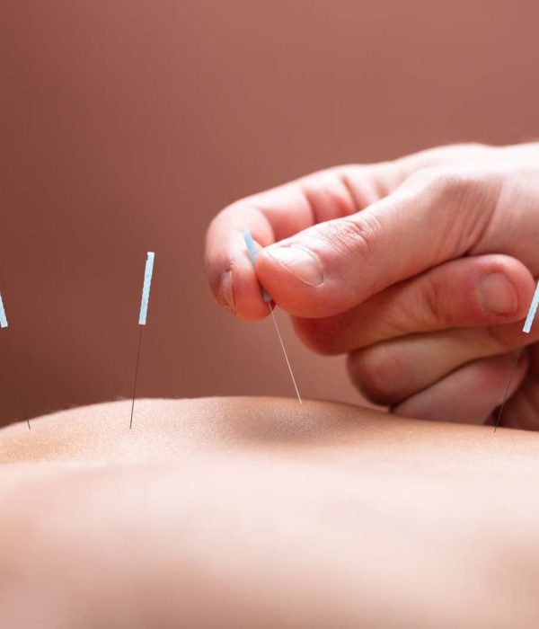 qu'est-ce que l'acupuncture qu'est-ce que l'acupuncture